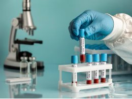 Lab Report Upload